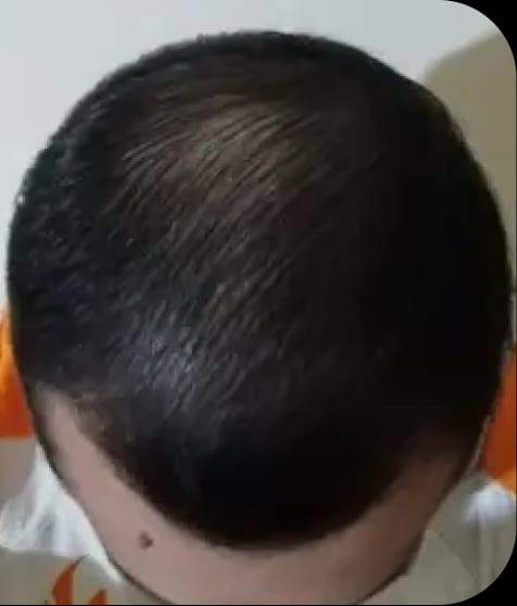 José tras 12 meses de tratamiento